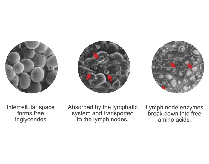 Newangie green light 10d laser slimming machine Newangie green light 10d laser slimming machine